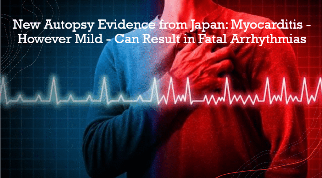 Arrhythmias - The Expose