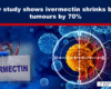 Expose News: New study claims ivermectin reduces brain tumors by 70%! Eye-catching medical discovery sparks excitement in healthcare world.