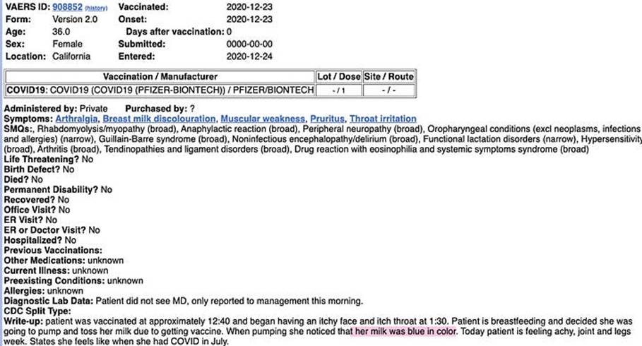 image - The Expose VAERS vaccination record for a 36-year-old female in California, dated 2020-12-23, with vaccine details, site/route, and listed symptoms (arthralgia, breast milk discoloration) and medical history notes.